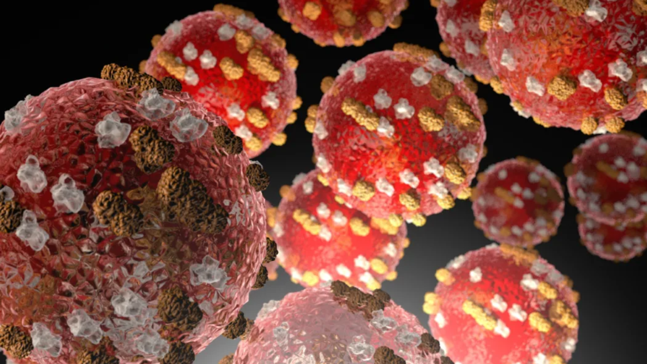 Pacific communities urged to get vaccinated as measles cases rise in NZ